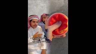 ابوعوضه Fyp Foryou اكسبلور الشعب الصيني ماله حل الهشتاقات للشيوخ ضحك فيديو مضحك نكت 