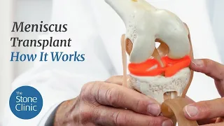 Meniscus Replacement - How it Works What to Expect
