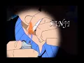 Sanji s Techniques Bonus Feature - One Piece DVD Season 3 Piece 1
