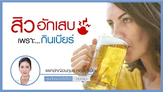 เบียร์ทำให้เกิดสิวได้อย่างไรบ้าง