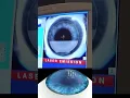 I Filmed My Lasik Eye Surgery So I Could See It
