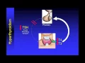 Understanding Thyroid Function Tests