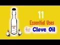 11 Essential Uses for Clove Oil