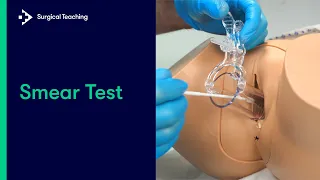 how to perform a pap smear