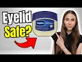 Is Vaseline Safe for Eyelids Milia Lash Growth Dry Skin Explained