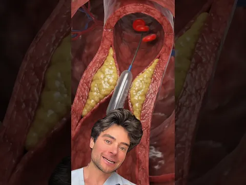 MIRA TUS ARTERIAS