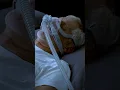 Download Lagu The Best treatment for Sleep Apnea