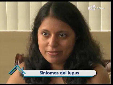 Tratamientos contra el lupus 