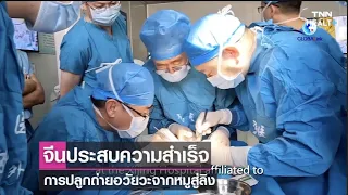  ทำไมนักวิจัยถึงทดลองปลูกถ่ายอวัยวะจากหมูไปยังลิง 