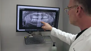 What are Full Arch Dental Implants The Implant Center at St Luke s OMS
