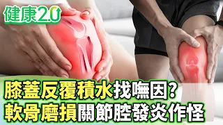 膝蓋反覆積水找嘸因？軟骨磨損關節腔發炎作怪【健康2.0分段】@tvbshealth20  EP3228-4 20260906 #陳欣湄#韋汝#江清泉#侯鐘堡#胡逸惟#鄒瑋倫#彥寬