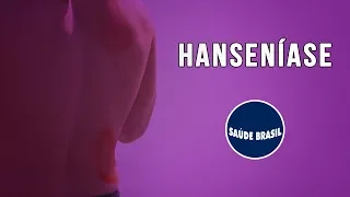 HANSENÍASE | SÉRIE SAÚDE BRASIL