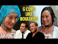 Melissa s Sagging G Cup Implants Are Ruining Her Life and Career Before After Botched E