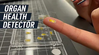 New Implant Can Track the Health of Organ Transplants in Real Time Mashable