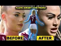 What The Hell HAPPENED to Alisha Lehmann s Face