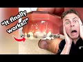 Braces Life Hack The Secret To Wax They Don t Want You To Know