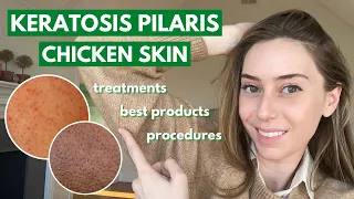 Download Keratosis Pilaris: How to treat dry bumpy skin aka chicken skin! | Dr. Shereene Idriss MP3