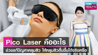 พิโคเลเซอร์ช่วยรักษาหลุมสิวได้จริงหรือไม่ และมีข้อจำกัดอย่างไรบ้าง