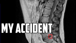 Sail Life – My Accident (three years ago)