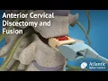 Anterior Cervical Discectomy and Fusion
