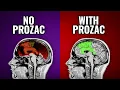5 Things You NEED To Know About Prozac Fluoxetine