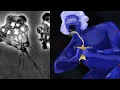 You Don t Know Brain Eating Amoeba