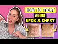 Download Lagu How to Prevent Aging on Your Neck \u0026 Chest | Dr. Shereene Idriss
