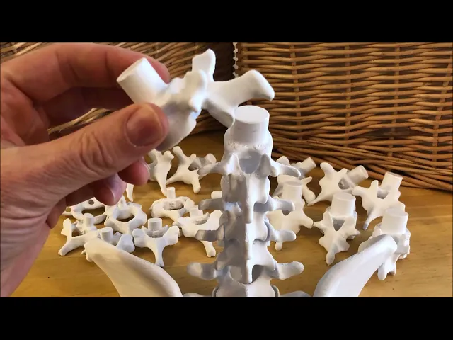 Vertebral Stacking Blocks video thumbnail
