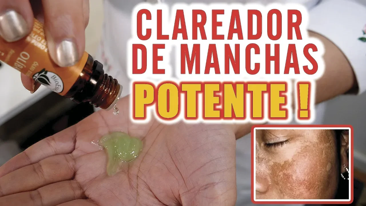 PELE DE BEBÊ - Usar PÓ ROYAL remove MANCHAS e RUGAS da PELE em 2 dias ???