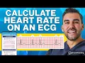 How to Calculate Heart Rate on ECG Easy Steps to Master Pulse Counting