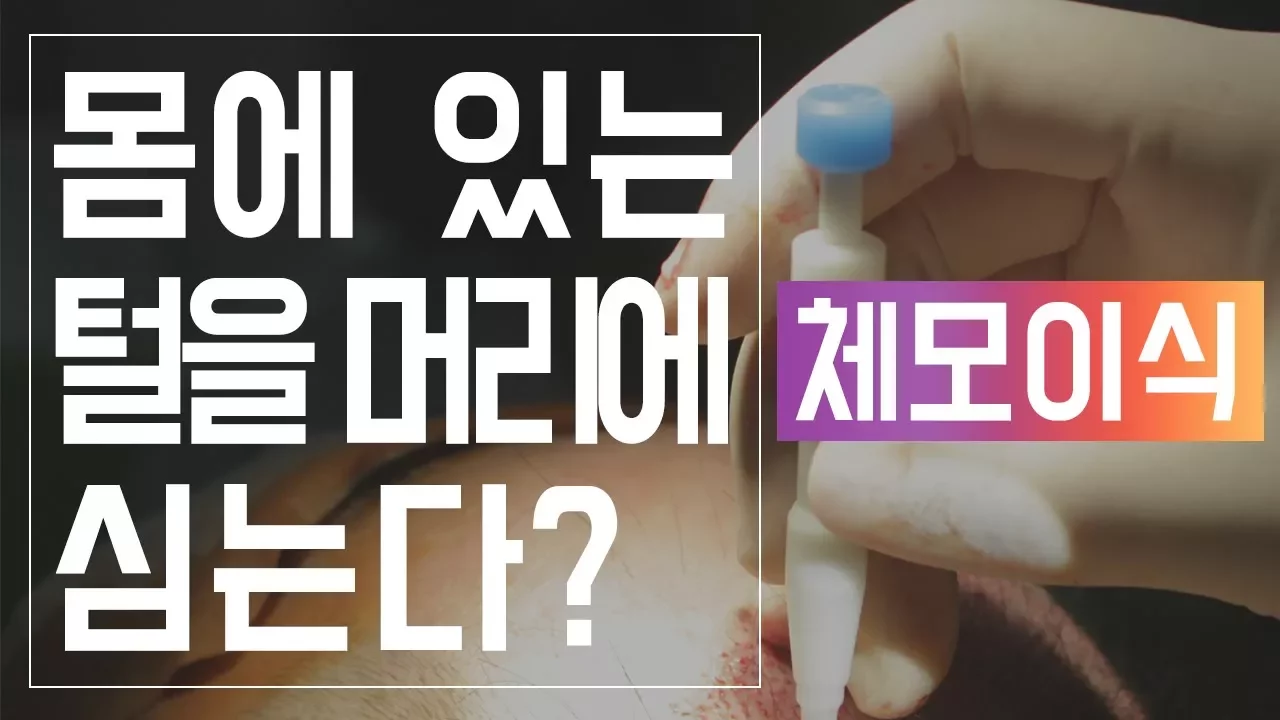 의느님답변📂ㅣ몸에 있는 털을 머리에 심는다고? 체모이식의 모든것