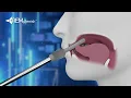 REMplenish Proper Use Animation