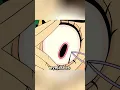 She has Flies living in her eyes
