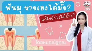  ฟันผุแบบที่เป็นจุดขาวๆ หรือขุ่นๆ สามารถหายเองได้ไหม 