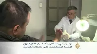 العلاج بريقات الذباب علاج غريب لكنه مفيد 