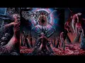 Download Lagu Traumatomy - Monolith of Absolute Suffering (Full Album 2015 HD)