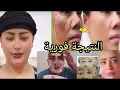 Download Lagu وجهك غيدجبد ابحال الطعربجة.النتيجة فورية بصح.المقشر عمليه هوا الاول ودعيو ب الشفاء
