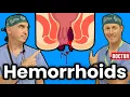 How To Get Rid Of Hemorrhoids
