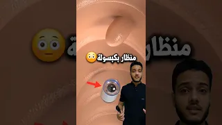 تصوير الجهاز الهضمي بالكبسوله Shorts 