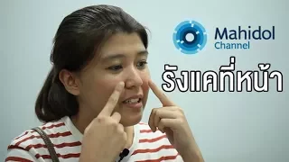 ผื่นที่ขึ้นบนหน้า ซึ่งเริ่มจากจุดแดงเล็ก ๆ และลามมาที่คาง เป็นโรคอะไร และเกิดจากสาเหตุใด