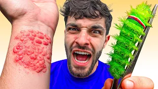 ‼️PICADO Por ORUGA GRINCH‼️ - Peores Picaduras #25