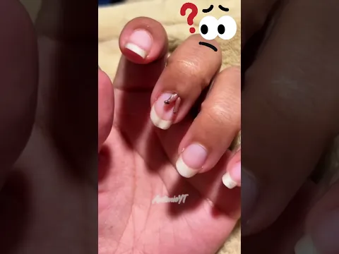 ¿Qué es esta cosa extraña en tu dedo 💅🧐😱