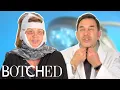 Dr Nassif Fixes Lisa s Facelift Gone Wrong FULL TRANSFORMATION Botched E