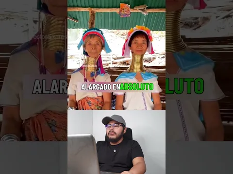 El oscuro secreto de las mujeres jirafa lo que nadie te cuenta sobre sus anillos