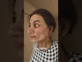 Download Lagu The Facelift That Left Her Eyes Stuck Open 😳