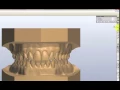 How to View Your Digital Study Models