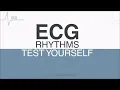 ECG Rhythms for self-assessment Test ECG Interpretation Skills
