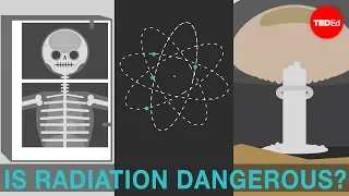 Is radiation dangerous - Matt Anticole
