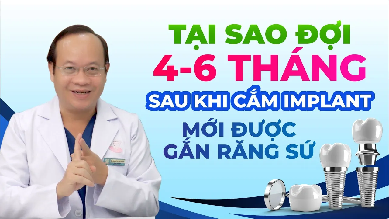 Outline Video TẠI SAO PHẢI ĐỢI 4-6 THÁNG SAU KHI CẮM TRỤ IMPLANT MỚI ĐƯỢC GẮN RĂNG SỨ