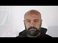 TMJ Headaches are NO Joke Is there is a cure for TMJ